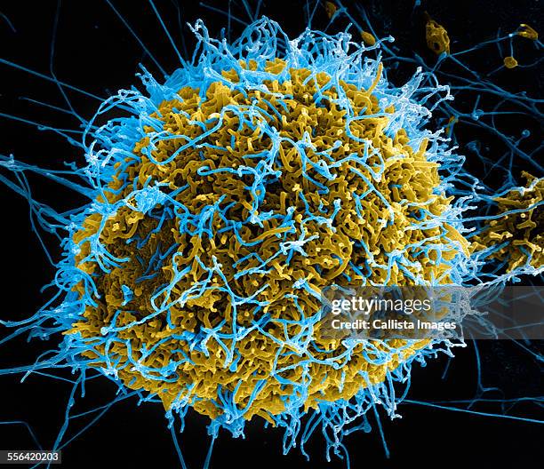 filamentous ebola virus particles (colored blue) budding from a chronically-infected vero e6 cell (colored yellow) - ebola stock pictures, royalty-free photos & images