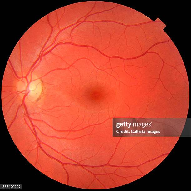 Normal Eye Dissection 59 Normal Anatomy Of The Eye Stock Photos, High-Res Pictures, and ...