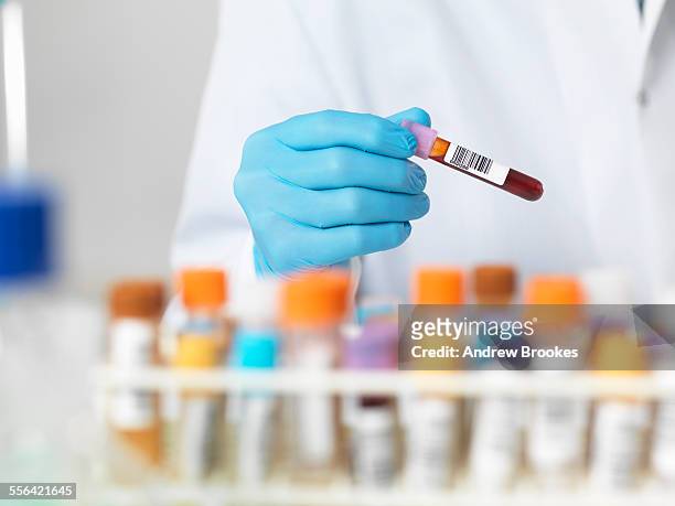 close up of scientists hands selecting a blood sample for medical testing - hematology 個照片及圖片檔