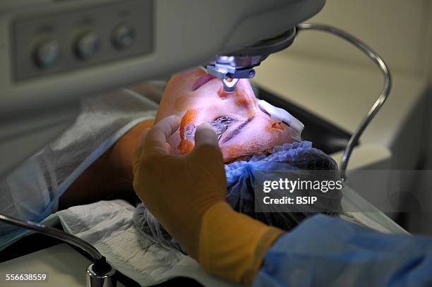 Eye Laser Surgery, Refractive eye surgery at the Adolphe de Rothschild Ophthalmology Foundation in Paris, Eye surgery using a femtosecond laser and...