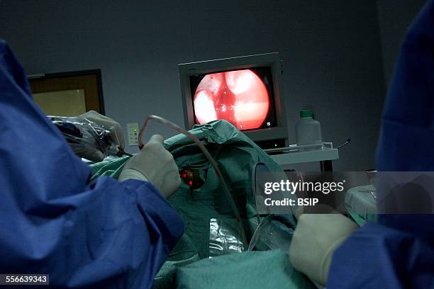 Surgery On The Nose, Reportage in Lisbon hospitals operating theatre, Portugal. Taking a sample of olfactory cells.