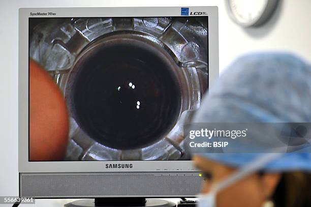 Eye Laser Surgery, Refractive eye surgery at the Adolphe de Rothschild Ophthalmology Foundation in Paris, Eye surgery using a femtosecond laser and...