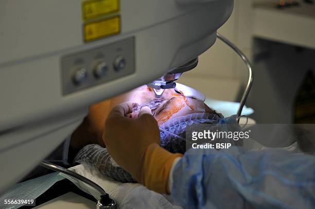 Eye Laser Surgery, Refractive eye surgery at the Adolphe de Rothschild Ophthalmology Foundation in Paris, Eye surgery using a femtosecond laser and...