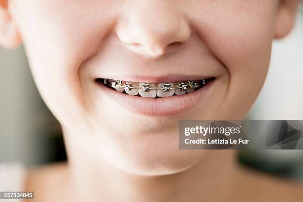 close-up of a girl smiling - braces and smiles stock pictures, royalty-free photos & images