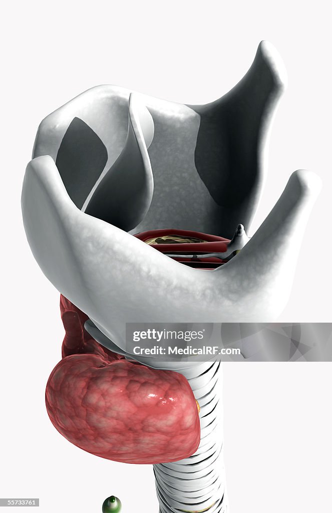 Lateral angled view of the larynx.