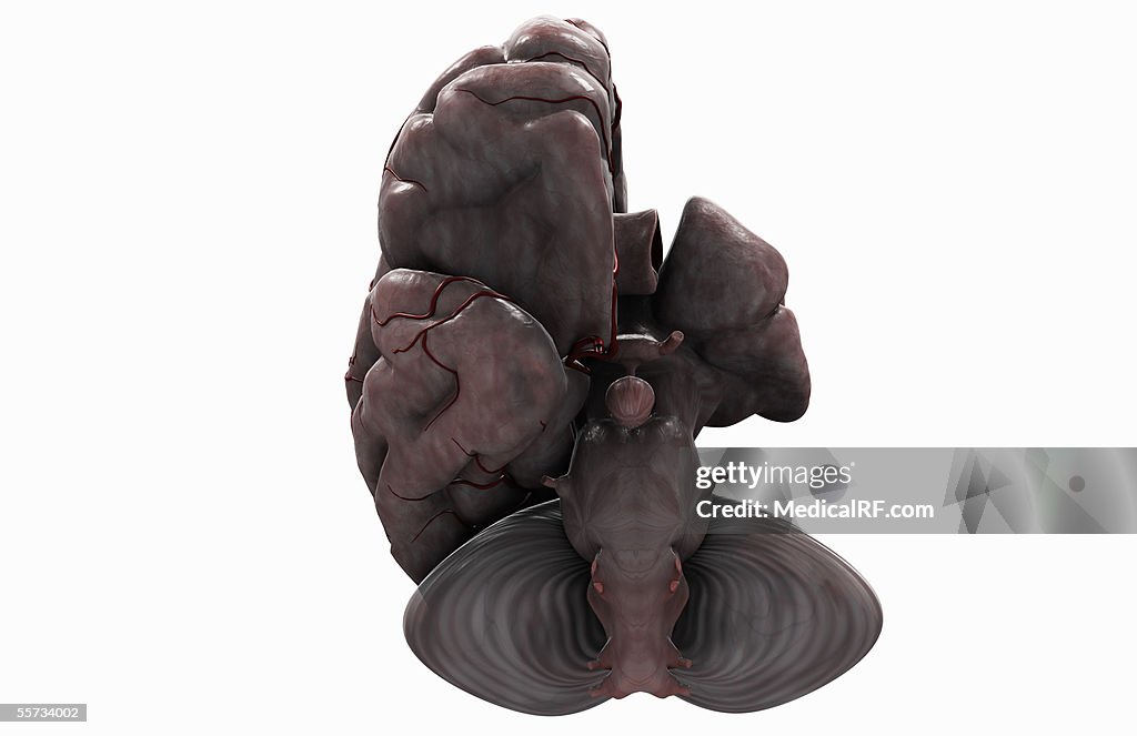 Inferior angled view of the brain with the left hemisphere removed.