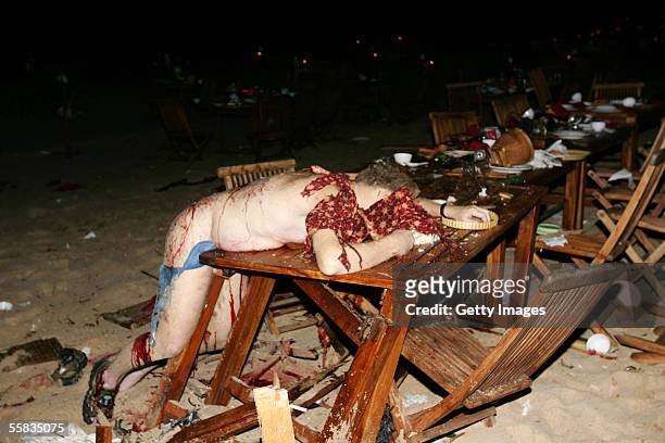 Bomb blast victim lies on a table October 1, 2005 in Bali, Indonesia. Several explosions were reported on Saturday evening in the Indonesian tourist...