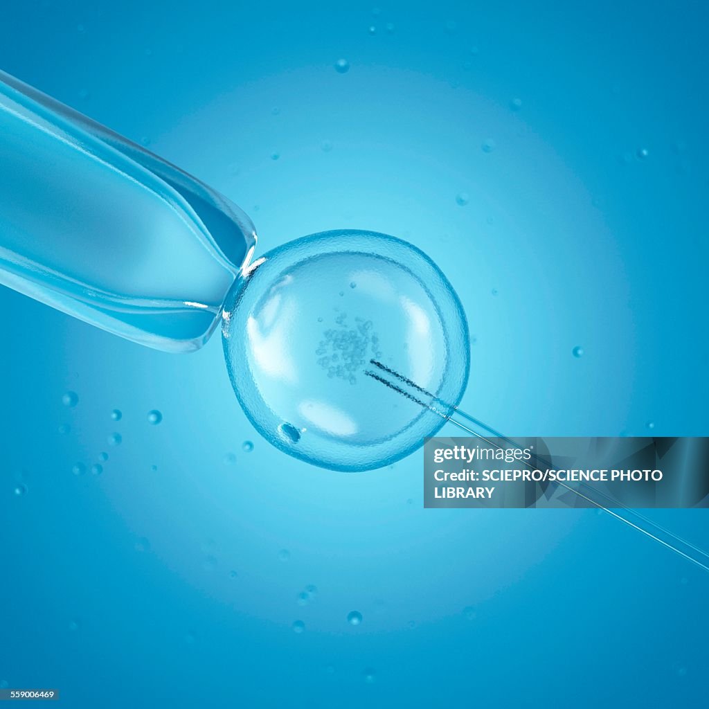 Ivf Computer Background Ivf Illustration High-Res Vector Graphic - Getty Images