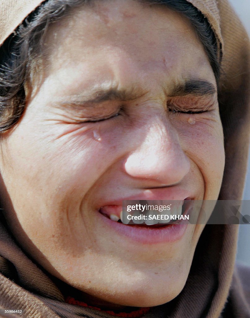 An injured Kashmiri girl cries in pain a