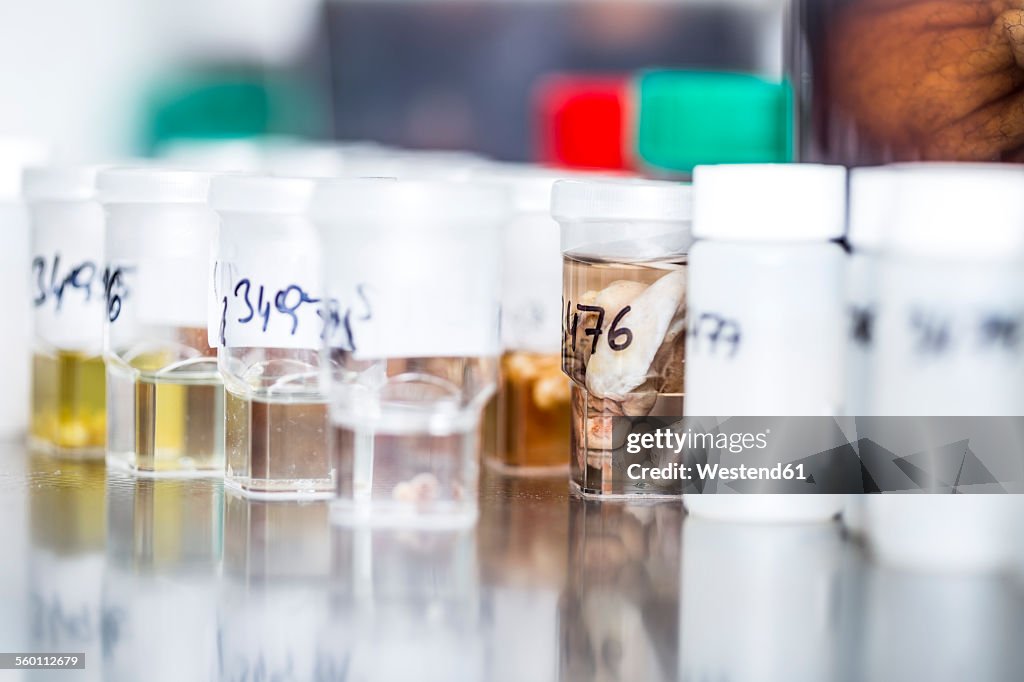Tissue Sample Collection Lab Design Tissue Samples In Clinical Laboratory High-Res Stock Photo - Getty Images