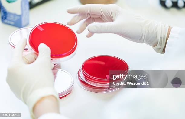 close-up of lab technician working with agar plates - agargel stock-fotos und bilder