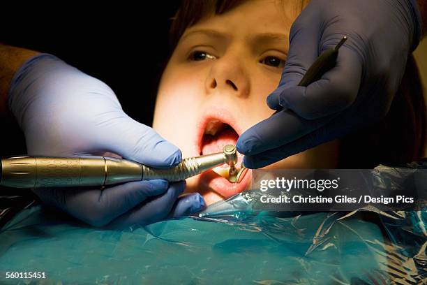 a girl undergoing treatment at the dentists office - christine buffer - fotografias e filmes do acervo