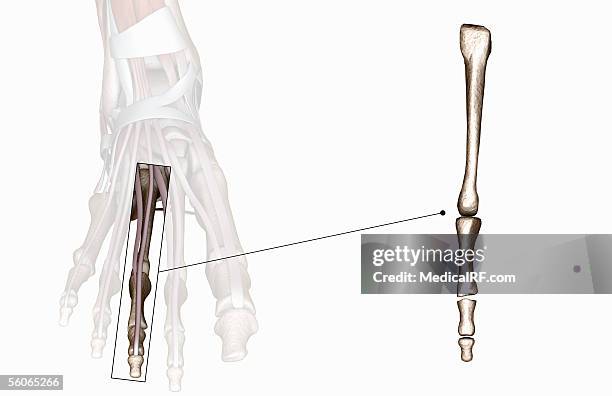 Navigular Hand 316 Navicular Bone Of Hand High Res Illustrations - Getty Images