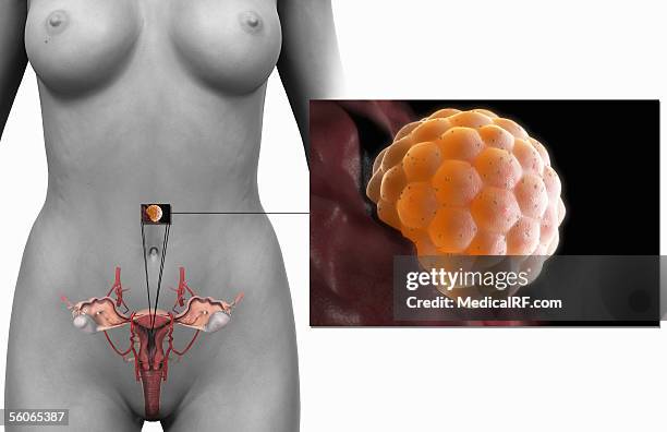 ilustraciones, imágenes clip art, dibujos animados e iconos de stock de a microscopic view of a fertilised female egg implanted in the endometrium wall from a frontal cross section of the female reproductive system. - uterine wall