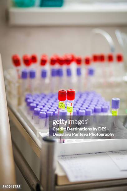 Vils Lab 20 Lab Viles Stock Photos, High-Res Pictures, and Images - Getty Images