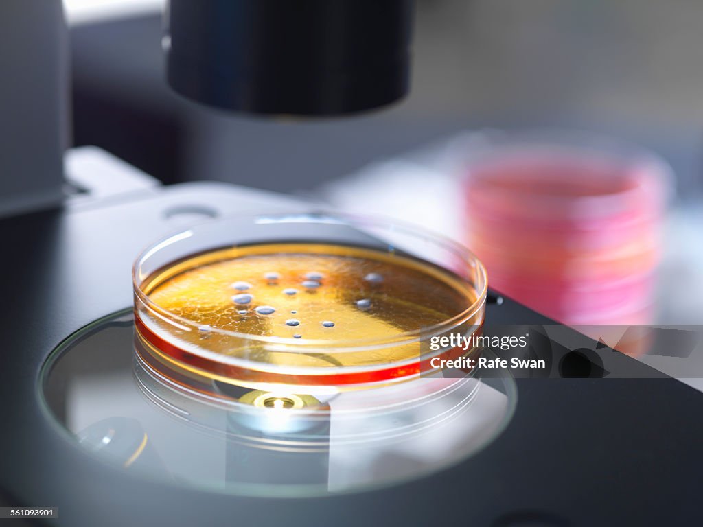 Petri dish containing bacterial culture being examined with inverted light microscope in microbiology lab