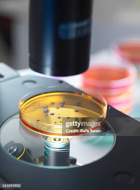 Light Microscopy Inverted 66 Inverted Microscope Stock Photos, High-Res Pictures, and Images ...