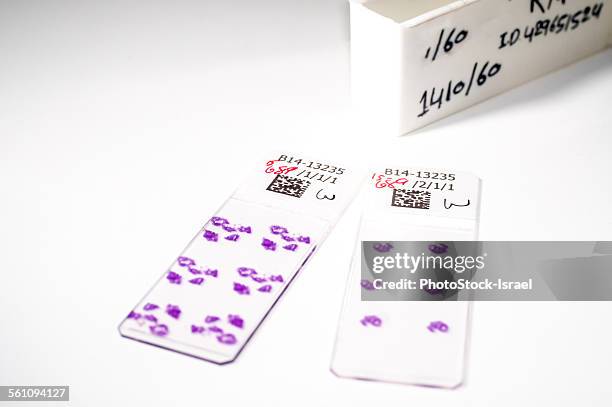 gastrointestinal biopsy slides - stained tissue samples taken from a womans gastrointestinal tract. slides will be examined under a microscope for abnormalities indicating crohns or infection - biopsy fotografías e imágenes de stock