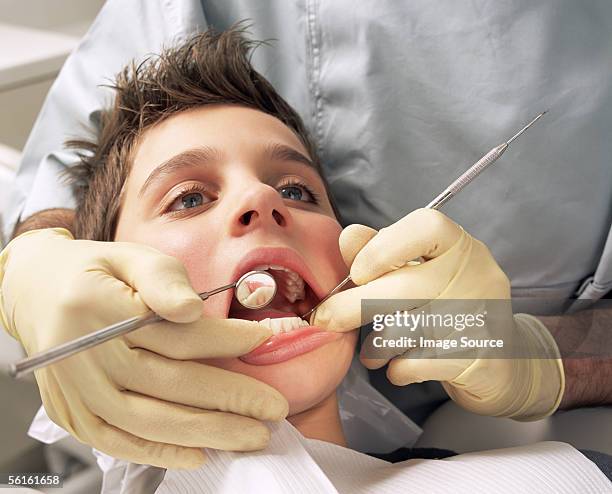 close-up di ragazzo con denti esaminato - dentista bambini foto e immagini stock