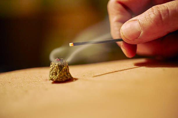 moxibustion - お灸 ストックフォトと画像
