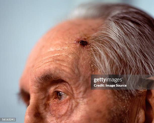 close-up of elderly man's head - head wound stock pictures, royalty-free photos & images