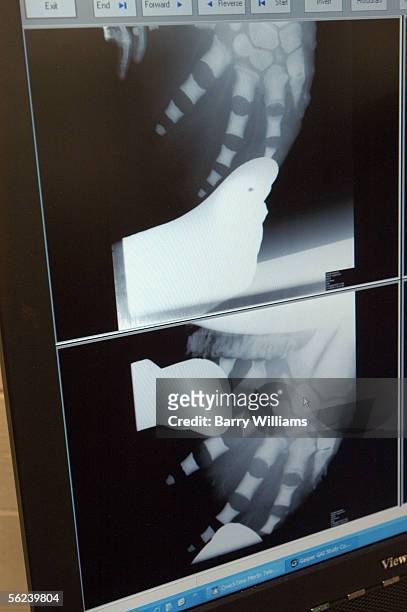 An X-ray of a Beluga Whale's fin is shown in the operating room at the Georgia Aquarium November 19, 2005 in Atlanta, Goergia. The Georgia Aquarium,...