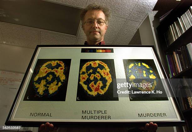Adrian Brain Prefrontal Photos and Premium High Res Pictures - Getty Images
