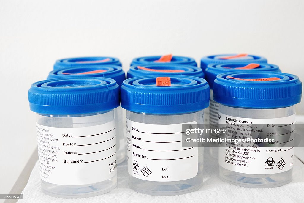 Six plastic medical specimen bottles