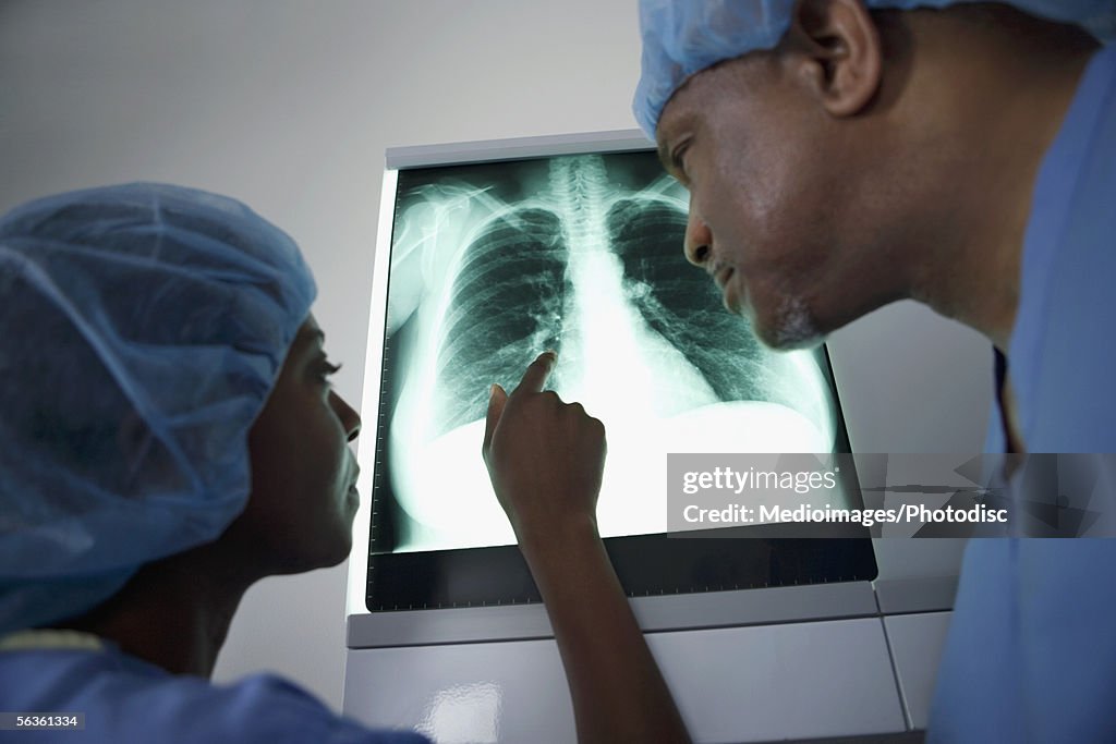 Two doctors having a discussion about an x-ray of a human lung