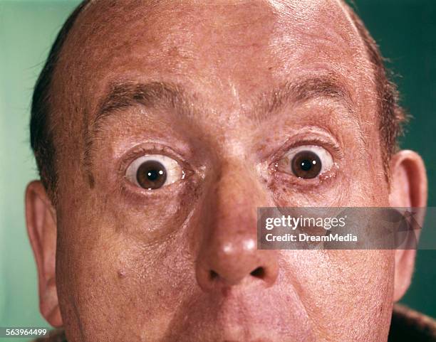 1960s CLOSE UP DETAIL OF FLORID MAN FACE WITH EYES OPEN WIDE AND STARING