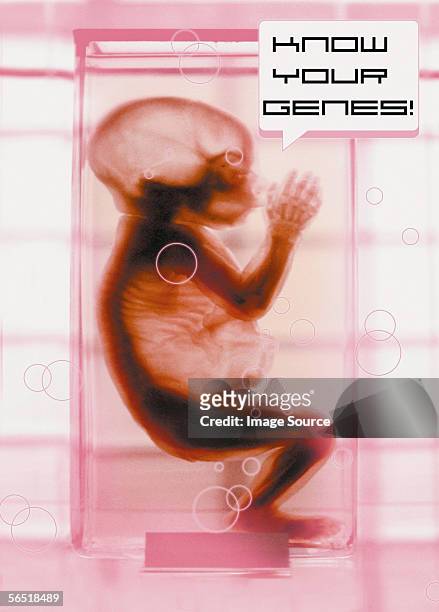 know your genes - dna radiogram bildbanksfoton och bilder