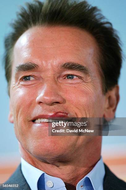 California Governor Arnold Schwarzenegger smiles as he speaks carefully with 15 stitches in his lip from a weekend motorcycle accident, as he visits...