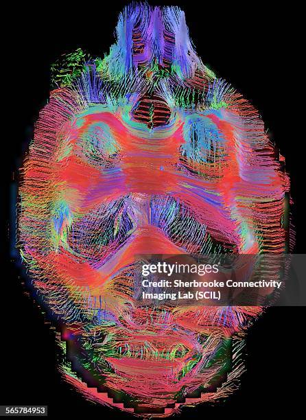 coronal view of rat brain connectivity. top view. images reconstructed at 300 microns isotropic - scientific imaging technique stock pictures, royalty-free photos & images