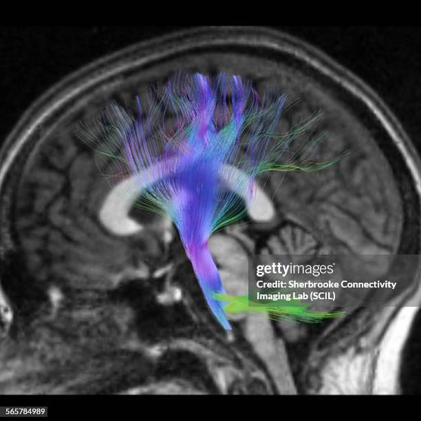 side view of the motor tract, the corticospinal tract - neuroanatomy stock pictures, royalty-free photos & images