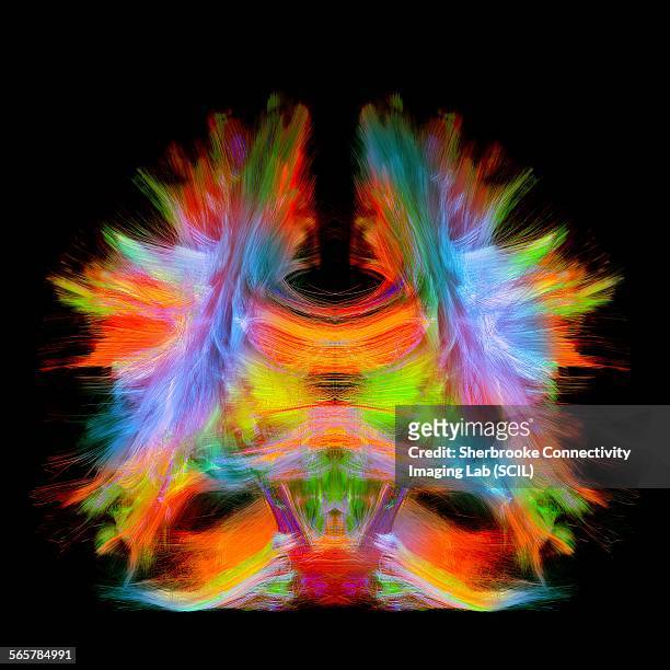 full brain tractography with artistic color. this is a full brain tracking coming from a super-resolution reconstruction of 0.6 cubic mm. front view. - brain scan stock-fotos und bilder