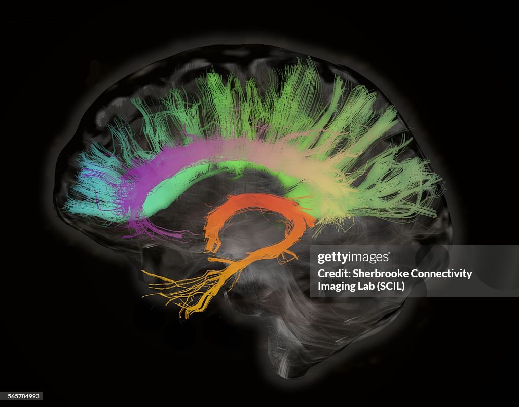 The fiber tracts involved in aging. The splenium and genu of the corpus callosum, the fornix and the cingulum bundle. Human subject