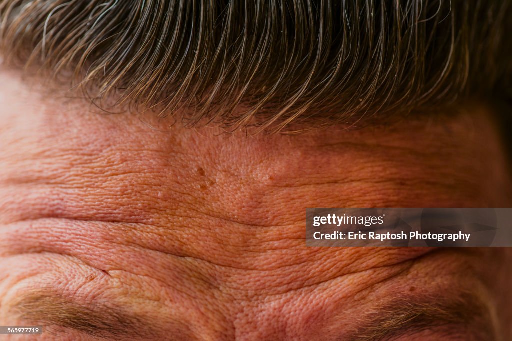 Strunkly Forehead Close Up Of Wrinkled Forehead Of Caucasian Man High-Res Stock Photo ...