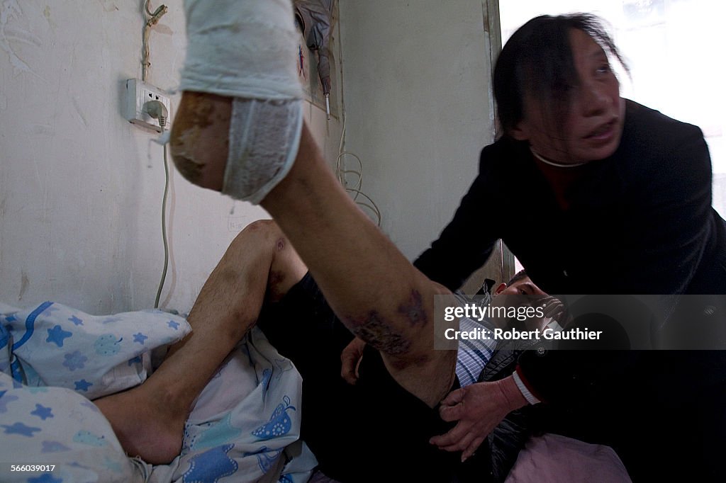 XIAN, CHINA, FEBRUARY 8, 2011  Mao Xiulian, 57, looks over the numerous injuries covering her son