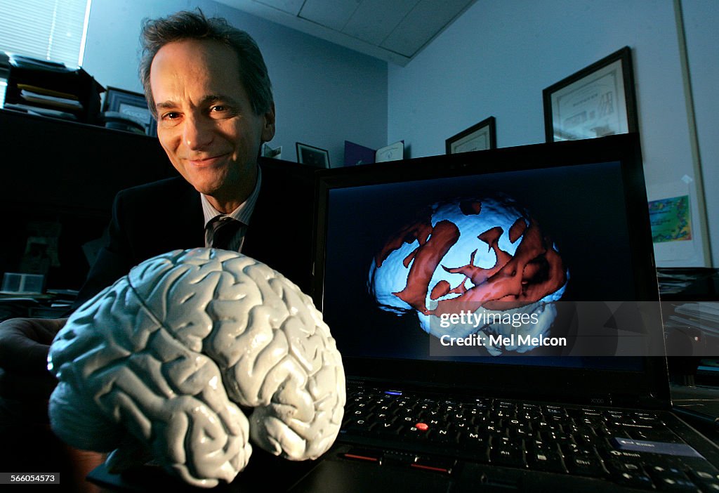 Dr. Gary Small, 57, a UCLA neuroscientist, is photographed next to a plastic model of the human bra