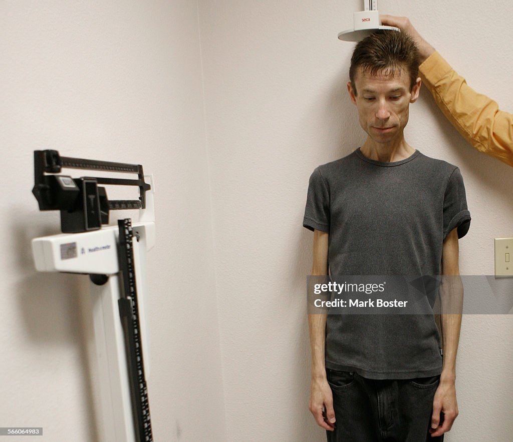 Anorexia patient Bryan Bixler is weighed and measured at the University of California San Diego Eat