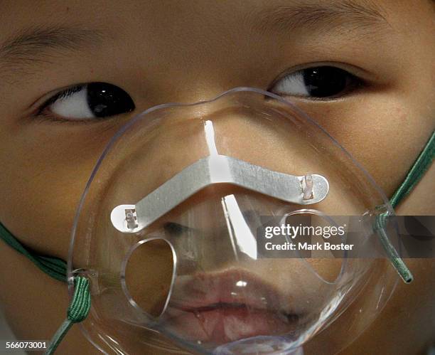 Elijah Puno from the Phillipines wears an oxygen mask while being treated for asthma and croup in the Emergency Room at Providence St. Joseph Medical...