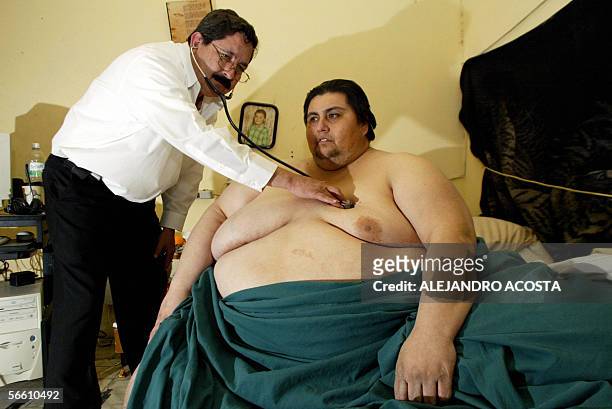 Mexico: Dr. Jaime Gonzalez checks Manuel Uribe with a weight of 550 kilos who suffers a morbid obesity for almost 20 years, 17 January 2006 in San...
