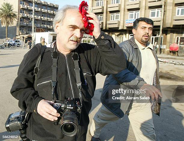 Magazine photographer, Franco Pagetti , holds a bandanna to his head to try and stop a wound from bleeding after two bombs went off in the area...