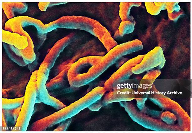 Produced by the National Institute of Allergy and Infectious Diseases , under a very-high magnification, this digitally-colourized scanning electron...