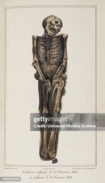 Studies of the effects of decomposition on exhumed bodies, 1831.