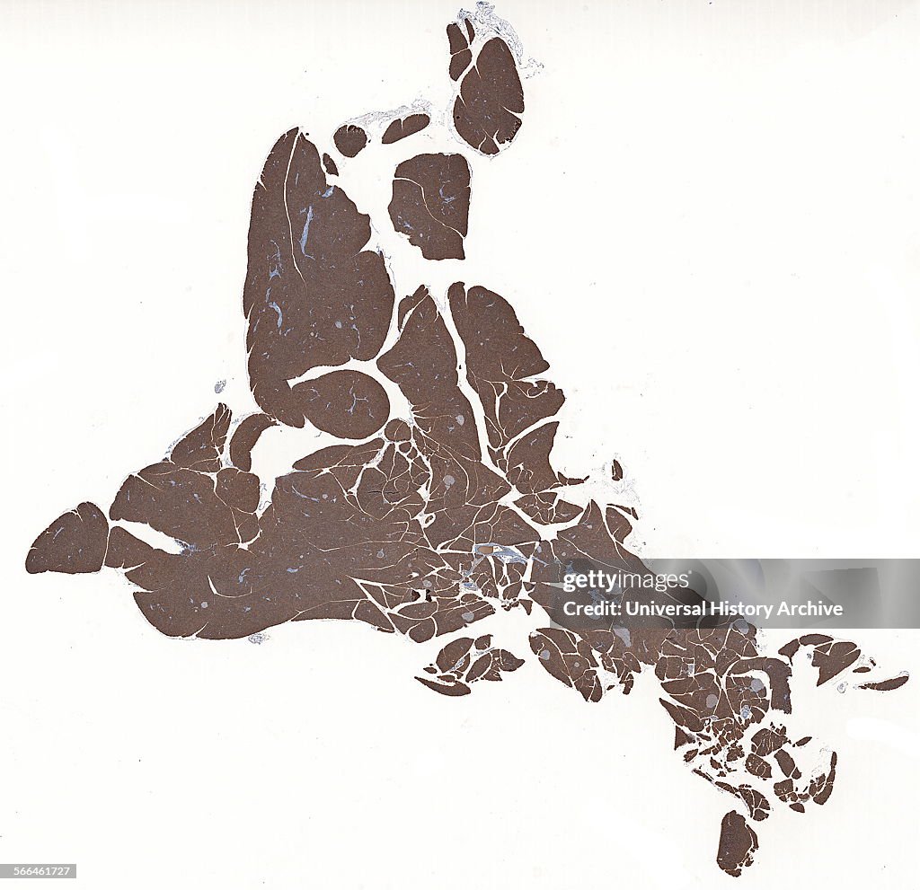 Immunoperoxidase staining of formalin-fixed, paraffin.