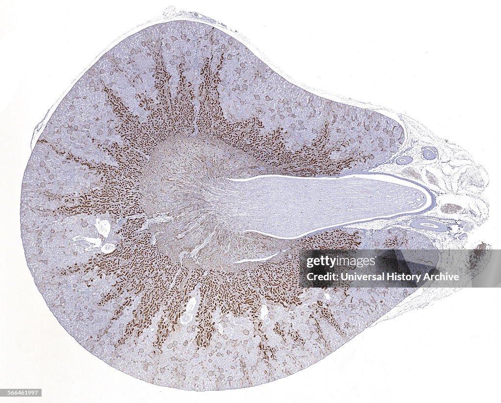 Immunoperoxidase staining of formalin-fixed, paraffin.