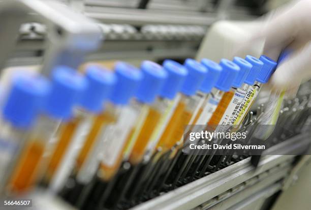 Human Lab Test 26 Israeli Laboratory Leads Western World In Blood Testing Stock Photos ...