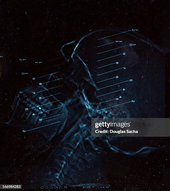 Mri Film Examples Mri Films Photos and Premium High Res Pictures - Getty Images
