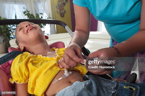 mother preparing feeding tube for small daughter with cerebral palsy - lawrence bildbanksfoton och bilder